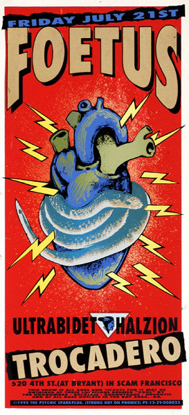 Foetus PSTR-PS031